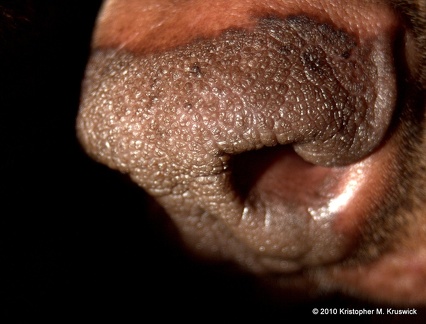 Nose